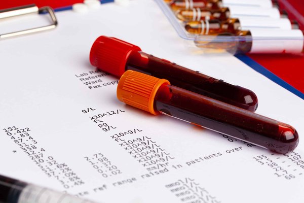 Comment reconnaître un bruit de courroie ?